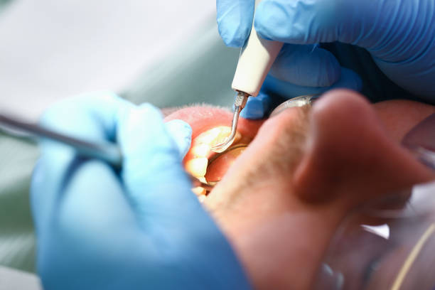 Best Broken or Chipped Tooth Repair in Thatcher, AZ